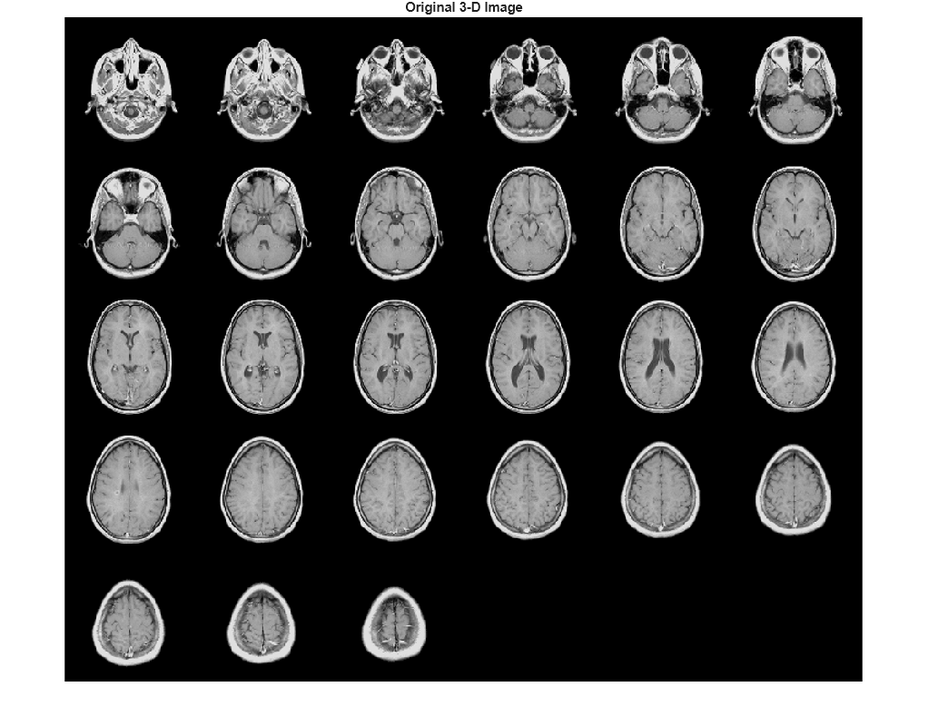 Figure contains an axes object. The hidden axes object with title Original 3-D Image contains an object of type image.