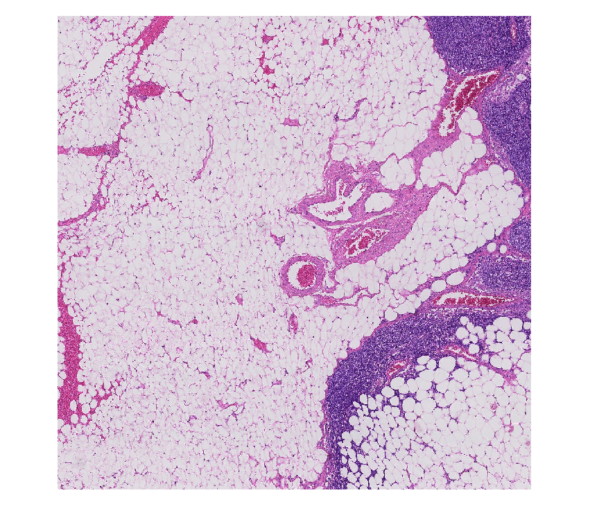 Figure contains an axes object. The hidden axes object contains an object of type image.