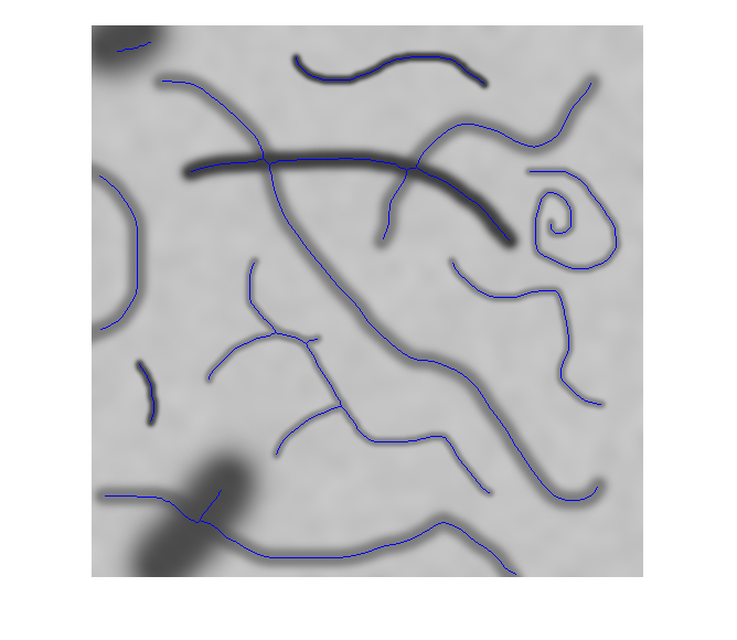 Figure contains an axes object. The hidden axes object contains an object of type image.