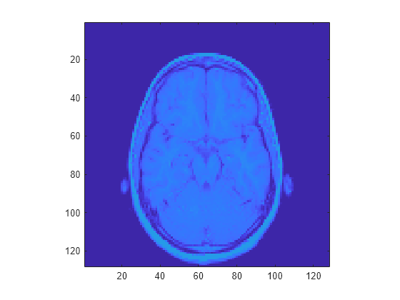 Figure contains an axes object. The axes object contains an object of type image.