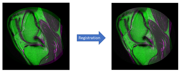 Affine Registration