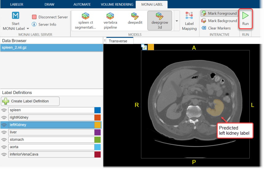 Medical Image Labeler app window, showing predicted left kidney labels in a transverse slice of a CT scan
