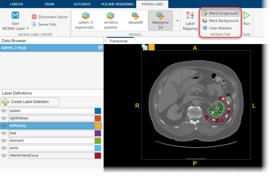 Medical Image Labeler app window, showing foreground and background markers drawn in a transverse slice of a CT scan
