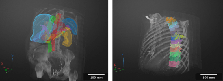 CT scans labeled using an automated MONAI Label model for multi-organ and vertebra segmentation