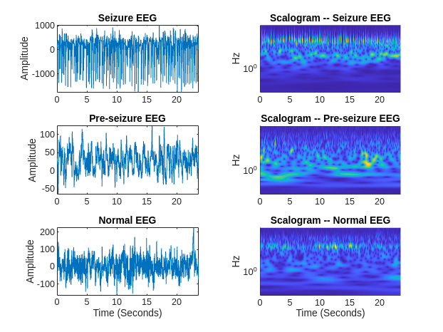 EEG データ分類のための時間-周波数畳み込みネットワーク