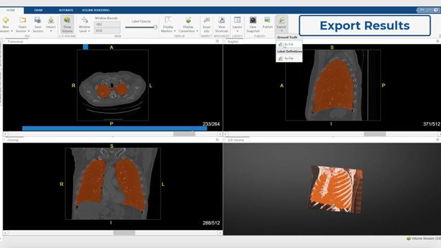 Display, Segmentation, and Processing of Medical Images with MATLAB - MATLAB